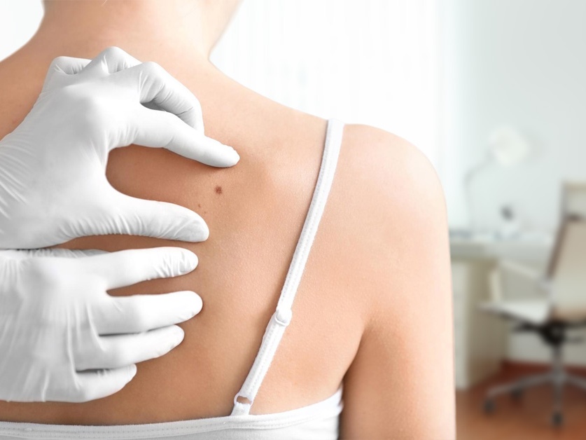 Kožní ambulance - MUDr. Štefan Dubáň